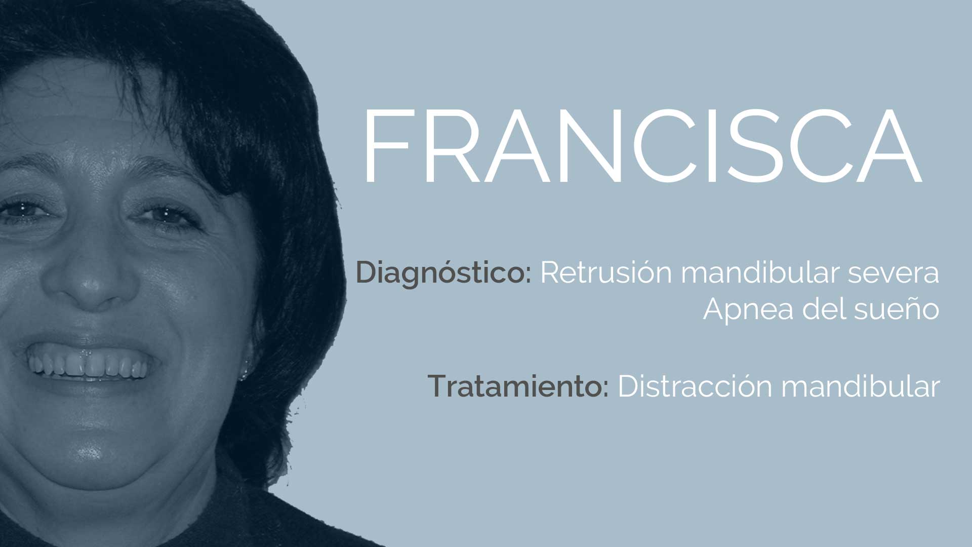 Francisca